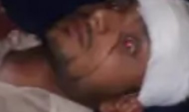 युवक पर अज्ञात नकाबपोश युवकों ने किया हमला