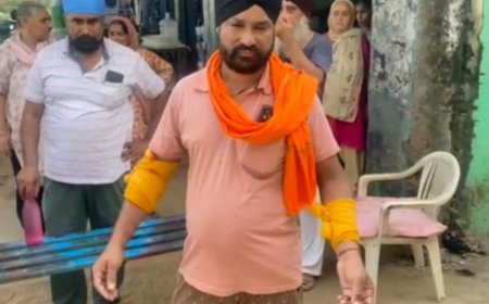 नोगांवा में बंदरो के हमले से एक ओर व्यक्ति बुरी तरह जख्मी