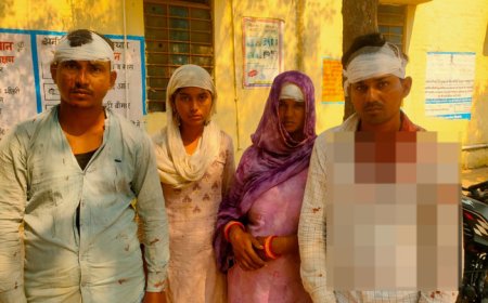 दो पक्षों में खेत पर छिड़ा खूनी संघर्ष एक दर्जन लोग चोटिल गम्भीर रूप से घायल को किया रेफर