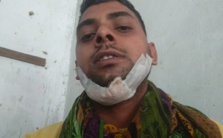 नौगांवा तहसील में आतंकी बंदरों का फिर दिखा आतंक