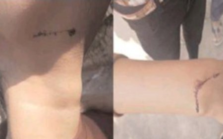 बैखौफ बाइक सवार बदमाशों ने धारदार हथियार से छात्राओं के गले और हाथ को काटा