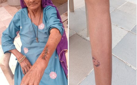 नांगल में लाल मुंह के बंदर का आतंक,  दर्जनों लोगों को काट किया घायल