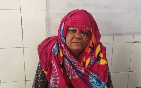 2 बीघा जमीन को लेकर बेटे ने मां पर किया जानलेवा हमला महिला का अस्पताल में इलाज जारी