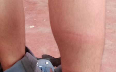 सात मिनिट देरी से पहुंचे छात्र की अध्यापक ने प्लास्टिक के पाइप से की पिटाई , कपड़े फटे