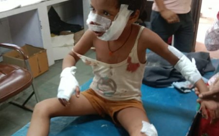 आवारा कुत्तों का आंतक नन्ही बालिका को काट कर किया घायल गंभीर अवस्था में अलवर रैफर