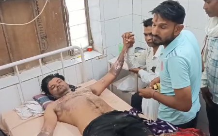 लाईन मैन की लापरवाही से युवक  युवक झुलसा, बिना सूचना दिए कर दी बिजली चालू