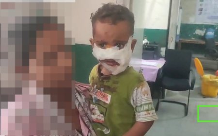 2 साल की बच्ची सहित तीन लोगों को कुत्ते ने बनाया शिकार