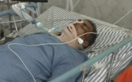 पैदल जा रहे पति-पत्नी को तेज रफ्तार कार ने मारी टक्कर : पत्नि की मौत, पति की हालत गंभीर