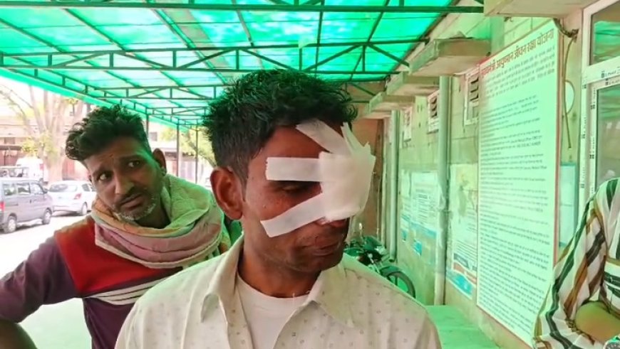 हवा भरते समय टायर फटने से जख्मी, अलवर रेफर