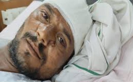 उधारी लेनदेन के विवाद में में फायरिंग: पीड़ित के मुंह पर देसी कट्टे का छर्रा लगा