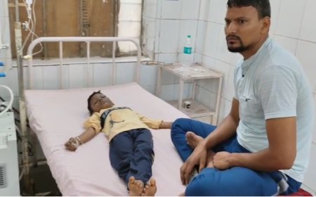 अनार हाथ में फटा बालक झुलसा;  लड्डू गोपाल को भोग लगा रही महिला के दीपक से साड़ी में लगी आग