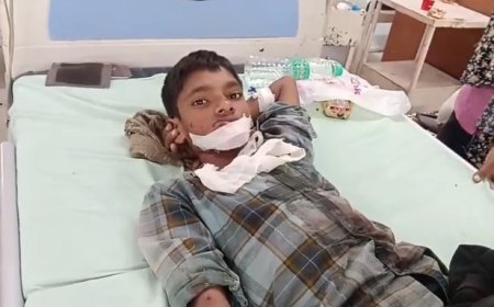 आतिशबाजी करते समय बम फटा भाई की उंगली हुई अलग, बहिन झुलसी