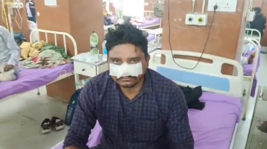 नाबालिग बेटे ने पिता के जगह जगह पर दांतों  से काट कर किया घायल; इसी ने'दो दिन पहले इसी ने कृष्ण जी की मूर्ति उखाड़ फेंकी