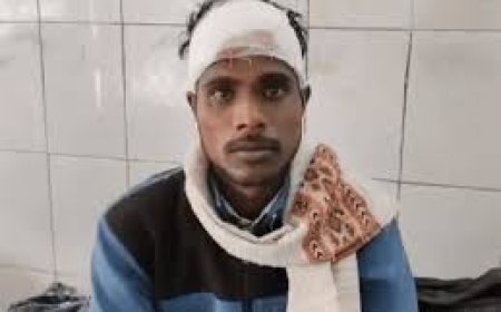 ट्रेन में सीट पर पैर रखने पर झगड़ा, यात्री का सिर-फोड़ा: दो महिलाओं-युवक ने की गाली-गलौज