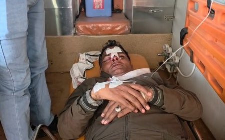 बिजली की चोरी पकड़ने गई विजिलेंस टीम पर हमला: लाठी-डंडों और लात घूंसों से की मारपीट, AEN समेत 4 कर्मचारी घायल, लाइनमैन की हालत गंभीर