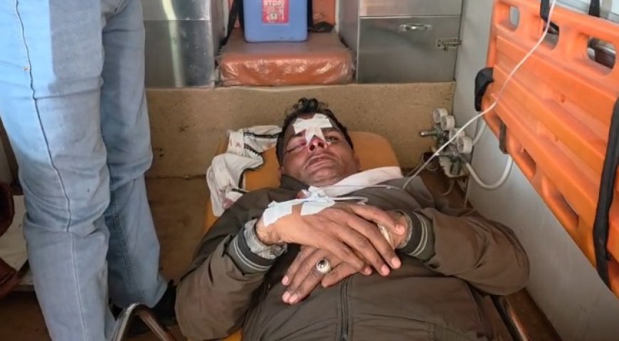 बिजली की चोरी पकड़ने गई विजिलेंस टीम पर हमला: लाठी-डंडों और लात घूंसों से की मारपीट, AEN समेत 4 कर्मचारी घायल, लाइनमैन की हालत गंभीर