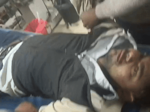 दो बाइकों में आमने-सामने की भिड़ंत, एक्सीडेंट में सरकारी टीचर समेत दो घायल; अलवर किया रैफर