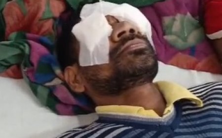 अलवर में केमिकल फैक्ट्री में हादसा, मजदूर की आंखें झुलसीं