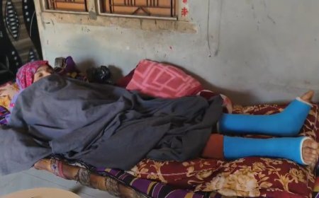 बंदरों से बचने के लिए छत से कूदी महिला: दोनों पैरों में फ्रैक्चर हो गया, ईओ बोलीं- टेंडर होने के बाद पकड़ेंगे