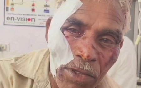 घर लौट रहे बुजुर्ग पर जानलेवा हमला: रास्ते में घेरकर बदमाशों ने लट्ठ और धारदार हथियारों से पीटा, हालत गंभीर