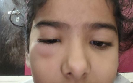 खैरथल में शिक्षा मंदिर पर सवालः शिक्षक की पिटाई से प्रेप की छात्रा की आंख में लगी चोट