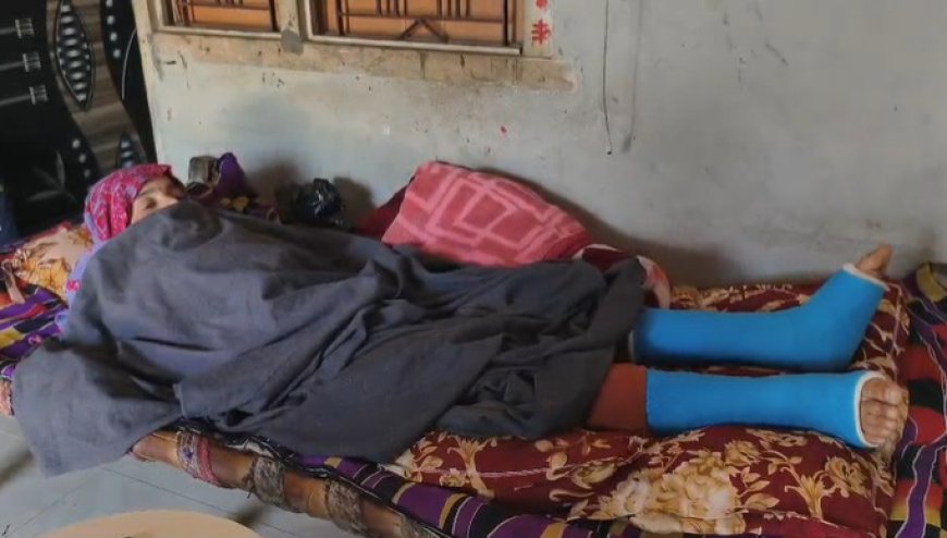 बंदरों से बचने के लिए छत से कूदी महिला: दोनों पैरों में फ्रैक्चर हो गया, ईओ बोलीं- टेंडर होने के बाद पकड़ेंगे