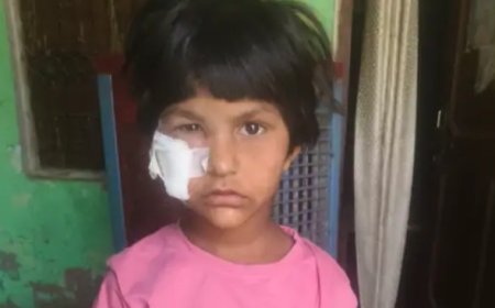 दहशत: 8 साल की बच्ची पर कुत्ते ने किया हमला, आंख के पास चोट के निशान, अलवर में इलाज जारी