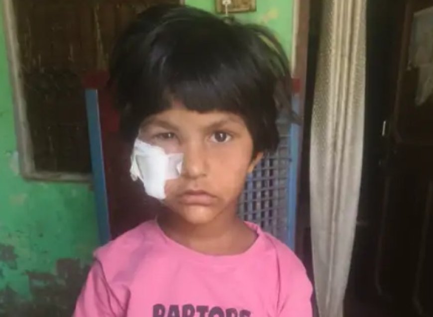 दहशत: 8 साल की बच्ची पर कुत्ते ने किया हमला, आंख के पास चोट के निशान, अलवर में इलाज जारी