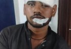 चौरीचौरा रेलवे स्टेशन पर टिकट सूची देखने गए युवक पर चाकू-डंडे से हमला, 1 नामजद समेत 13 पर केस दर्ज