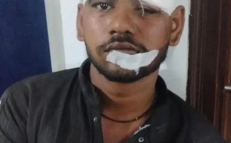 चौरीचौरा रेलवे स्टेशन पर टिकट सूची देखने गए युवक पर चाकू-डंडे से हमला, 1 नामजद समेत 13 पर केस दर्ज