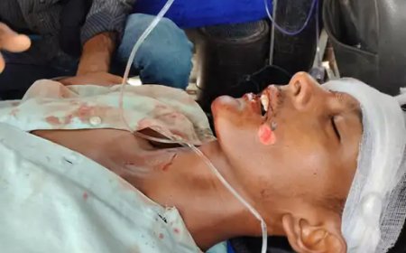 गोविंदगढ़ में थार ने दो भाइयों को टक्कर मारी: साइकिल पर स्कूल से लौट रहे थे, बड़े भाई के हाथ में फ्रैक्चर आया, अलवर रेफर