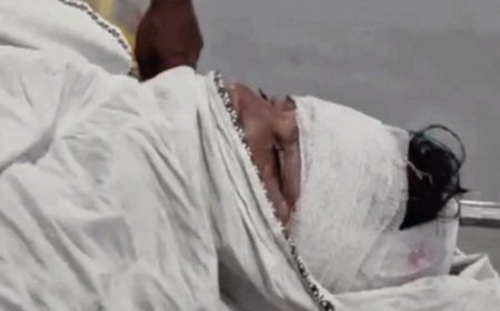 महज 1 बिस्वा जमीन के लिए खूनी खेल: गोविंदगढ़ में जेठ ने छोटे भाई की पत्नी पर फरसे से किया ताबड़तोड़ हमला, सिर में आए 15 टांके