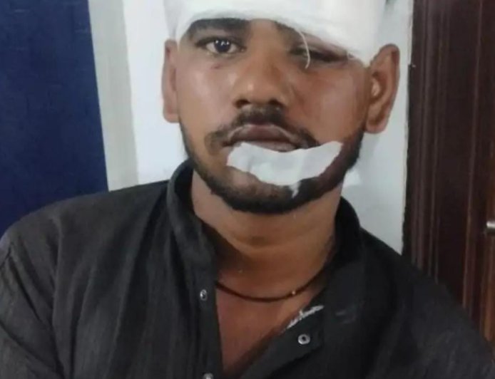 चौरीचौरा रेलवे स्टेशन पर टिकट सूची देखने गए युवक पर चाकू-डंडे से हमला, 1 नामजद समेत 13 पर केस दर्ज