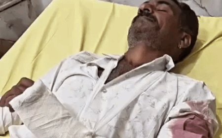 भीलवाड़ा में बेखौफ बदमाश: खेत जा रहे दंपती को कार से मारी टक्कर, मारपीट कर सोने का मांदलिया लूटा