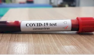 गोविंदगढ़ क्षेत्र मे कोरोना पॉज़िटिव आने से  फैली दहशत