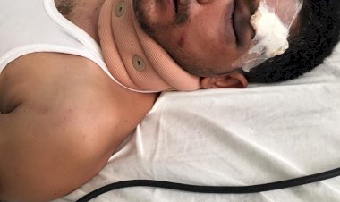 नो पार्किंग जॉन में खड़े ट्रक से टकराकर पत्रकार हुआ घायल