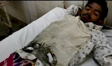 जेब में रखा मोबाइल फोन फटने से युवक घायल भरतपुर रैफर