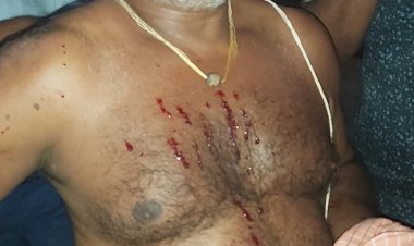 भीलवाड़ा में रपट के बालाजी के पुजारी के साथ मारपीट ,हिंदू संगठनों में भारी रोष