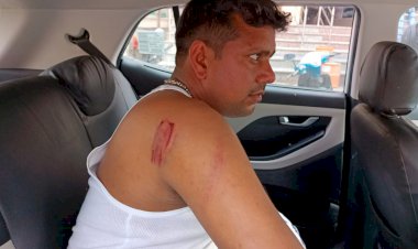 बर्डोद टोलकर्मियों की दबंगाई शादी से लौट रहे युवक को बेरहमी से पीटा, पुलिस ने नहीं लिखी 10 घंटे तक FIR
