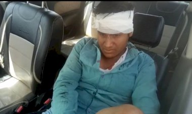 हवा भरते समय फटा गाड़ी का टायर, युवक हुआ गंभीर रूप से घायल