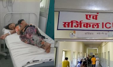 निर्दय पिता ने 15 वर्षीय पुत्री पर उड़ेला उबलता गर्म पशु आहार