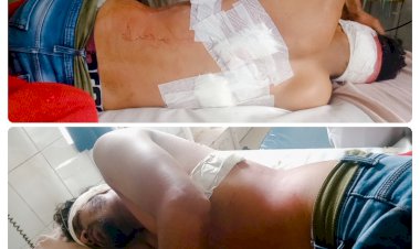 एक बार फिर हुई चाकूबाजी, बेखौफ अपराधी ने किए चाकू से 3-4 वार