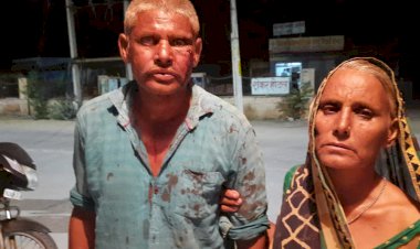 जमीनी विवाद को लेकर दो पक्षों में लाठी भाटा जंग, मामला दर्ज