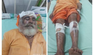 अज्ञात बदमाशाे ने मैथना के तपसी मंदिर के तीन साधुओं से धारदार हथियाराे से बेरहमी से की मारपीट