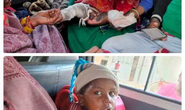 खेलते हुए मोबाईल की बैटरी फटने से दो बालक हुए घायल